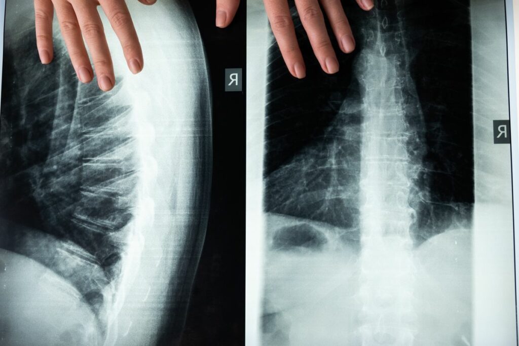 X-Ray
